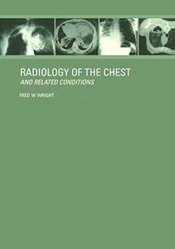 portada Radiology of the Chest and Related Conditions (en Inglés)