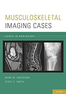 portada Musculoskeletal Imaging Cases (Cases in Radiology) (en Inglés)