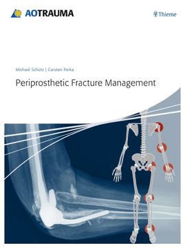 portada Periprosthetic Fracture Management (en Inglés)