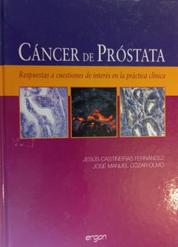 portada Cancer de Prostata: Respuestas a Cuestiones de Interes en la Practicaclinica (in Spanish)