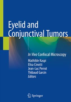 portada Eyelid and Conjunctival Tumors: In Vivo Confocal Microscopy (en Inglés)