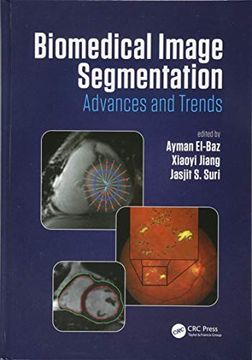 portada Biomedical Image Segmentation: Advances and Trends (en Inglés)