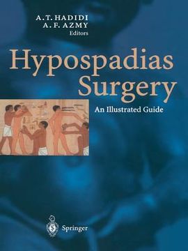 portada Hypospadias Surgery: An Illustrated Guide (in English)