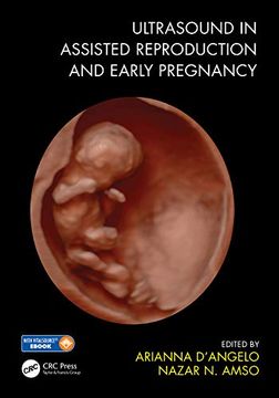 portada Ultrasound in Assisted Reproduction and Early Pregnancy