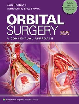 Orbital Surgery: A Conceptual Approach (en Inglés)