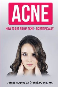 portada Acne: How to get rid of Acne - Scientifically (in English)