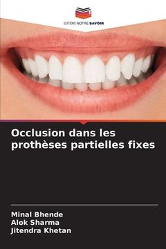 portada Occlusion dans les prothèses partielles fixes (in French)