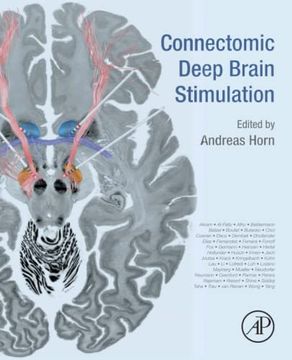 portada Connectomic Deep Brain Stimulation (en Inglés)
