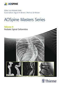 portada Aospine Masters Series, Volume 9: Pediatric Spinal Deformities Xyz (en Inglés)