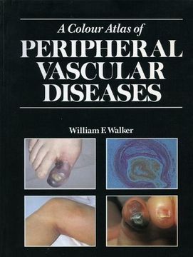 portada Colour Atlas of Peripheral Vascular Diseases