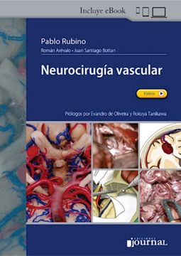portada Neurocirugia Vascular (in Spanish)