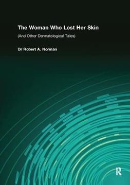 portada The Woman Who Lost Her Skin: (And Other Dermatological Tales) (en Inglés)