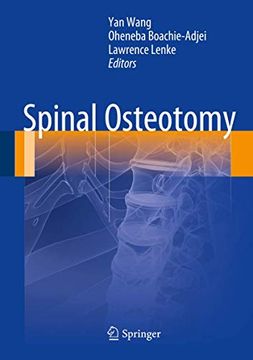 portada Spinal Osteotomy (en Inglés)