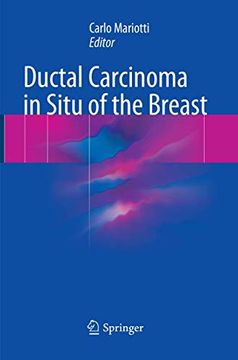 portada Ductal Carcinoma in Situ of the Breast (en Inglés)