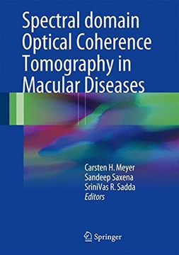 portada Spectral Domain Optical Coherence Tomography in Macular Diseases