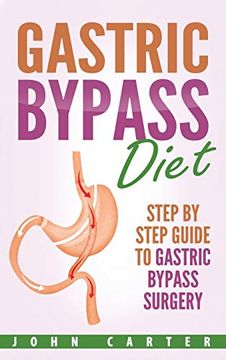 portada Gastric Bypass Diet: Step By Step Guide to Gastric Bypass Surgery 