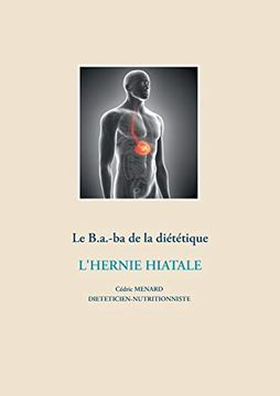 portada Le B. A. -Ba Diététique de L'hernie Hiatale (en Francés)