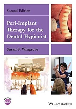 portada Peri-Implant Therapy for the Dental Hygienist