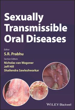 portada Sexually Transmissible Oral Diseases (en Inglés)