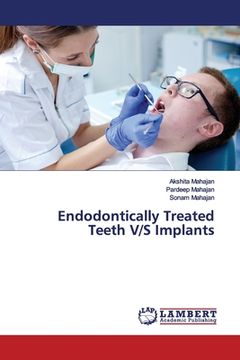 portada Endodontically Treated Teeth V/S Implants (en Inglés)