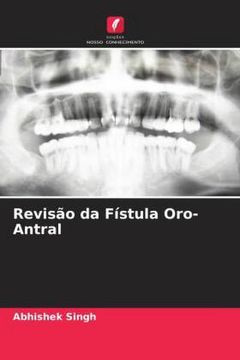 portada Revisão da Fístula Oro-Antral (en Portugués)