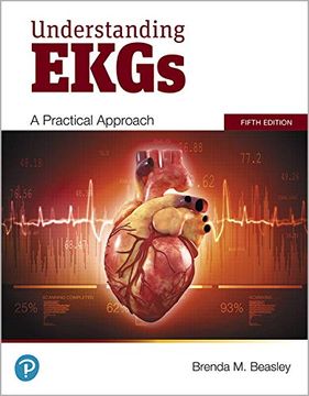 portada Understanding Ekgs (en Inglés)