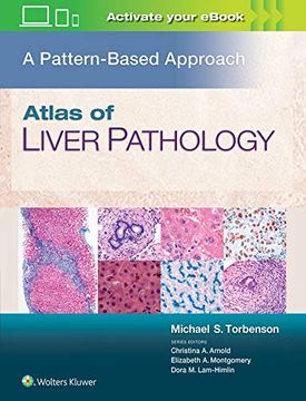 portada Atlas of Liver Pathology: A Pattern-Based Approach 