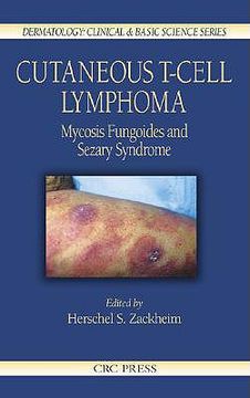 portada cutaneous t-cell lymphoma: mycosis fungoides and sezary syndrome (in English)