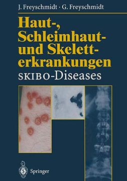 portada Haut-, Schleimhaut- und Skeletterkrankungen Skibo-Diseases: Eine Dermatologische-Klinisch-Radiologische Synopse (en Alemán)