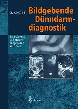 portada Bildgebende Dünndarmdiagnostik: Enteroklysma und Andere Bildgebende Verfahren (en Alemán)