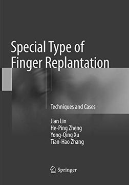 portada Special Type of Finger Replantation: Techniques and Cases (in English)