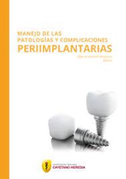 portada Manejo de las patologías y complicaciones periimplantarias (in Spanish)