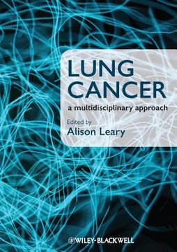 portada Lung Cancer: A Multidisciplinary Approach