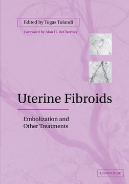 portada Uterine Fibroids: Embolization and Other Treatments (en Inglés)