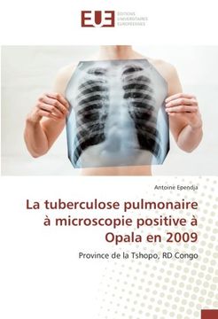portada La tuberculose pulmonaire à microscopie positive à Opala en 2009 (OMN.UNIV.EUROP.)