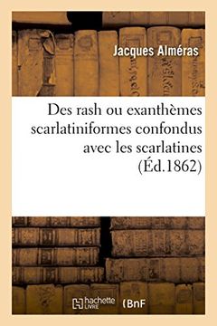 portada Des Rash Ou Exanthemes Scarlatiniformes Confondus Avec Les Scarlatines (Sciences) (French Edition)