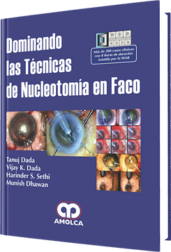 portada Dominando las Técnicas de Nucleotomía en Faco
