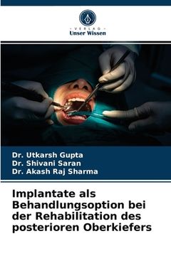 portada Implantate als Behandlungsoption bei der Rehabilitation des posterioren Oberkiefers