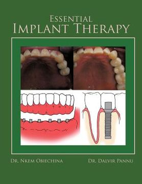 portada essential implant therapy: a patient's guide to understanding implant dentistry (in English)