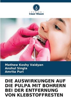 portada Die Auswirkungen Auf Die Pulpa Mit Bohrern Bei Der Entfernung Von Klebstoffresten (in German)