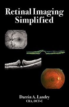 portada retinal imaging simplified (in English)