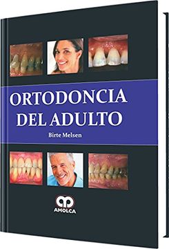 portada Ortodoncia Del Adulto