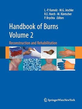 portada Handbook of Burns Volume 2: Reconstruction and Rehabilitation