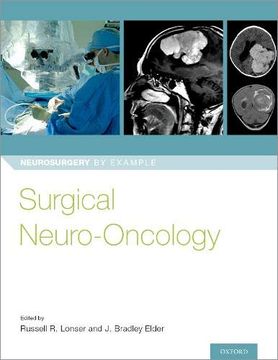 portada Surgical Neuro-Oncology (Neurosurgery by Example) (en Inglés)