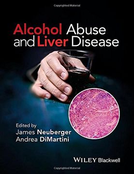 portada Alcohol Abuse and Liver Disease (en Inglés)