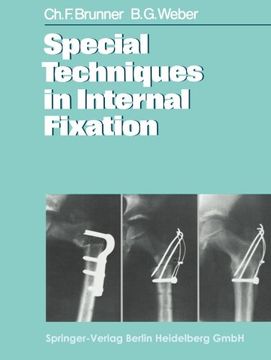 portada Special Techniques in Internal Fixation