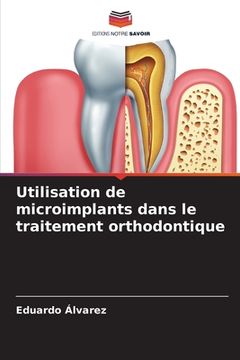 portada Utilisation de microimplants dans le traitement orthodontique (en Francés)