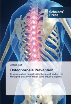 portada Osteoporosis Prevention: In vitro studies on cultivated bone cell and on the biological activity of novel bone inducing agents