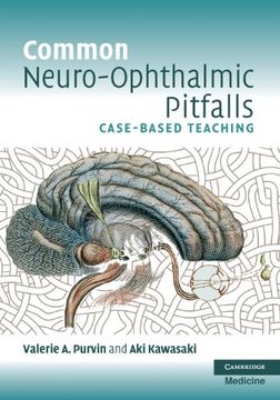 portada Common Neuro-Ophthalmic Pitfalls: Case-Based Teaching (Cambridge Medicine (Paperback)) (en Inglés)