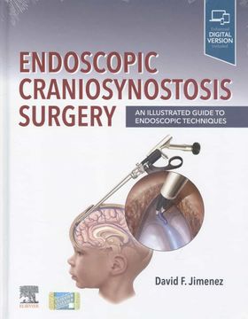 portada Endoscopic Craniosynostosis Surgery: An Illustrated Guide to Endoscopic Techniques (en Inglés)